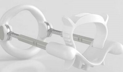 Extender per aumentare un membro